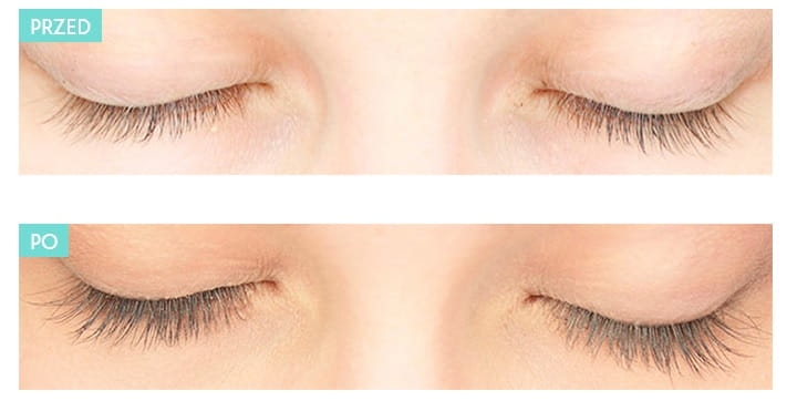 Realash odżywka efekty.jpg