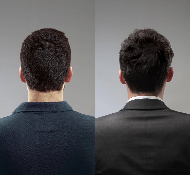 Hairvity Suplement dla mężczyzn Efekty.jpg