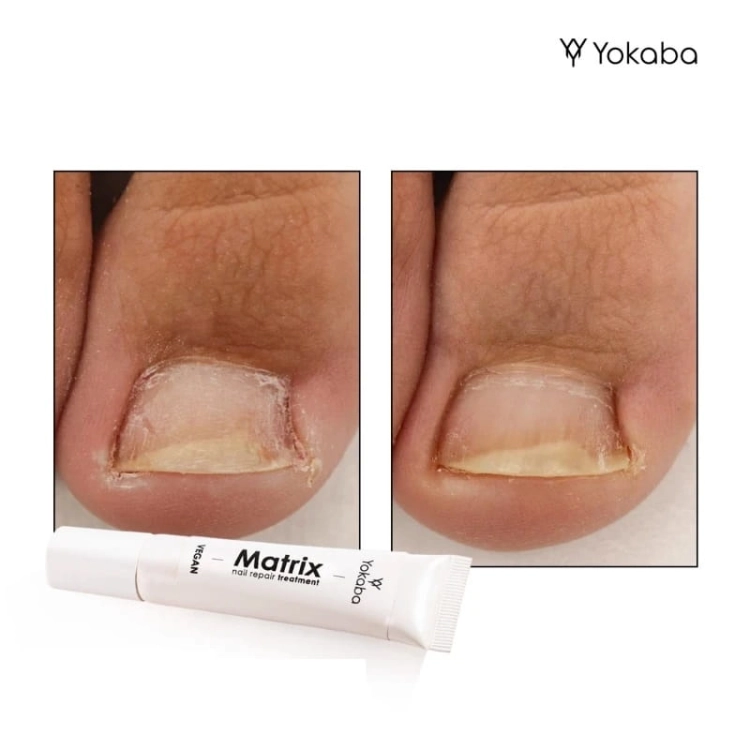 Yokaba matrix nail repair treatment Preparat do regeneracji paznokci 15g