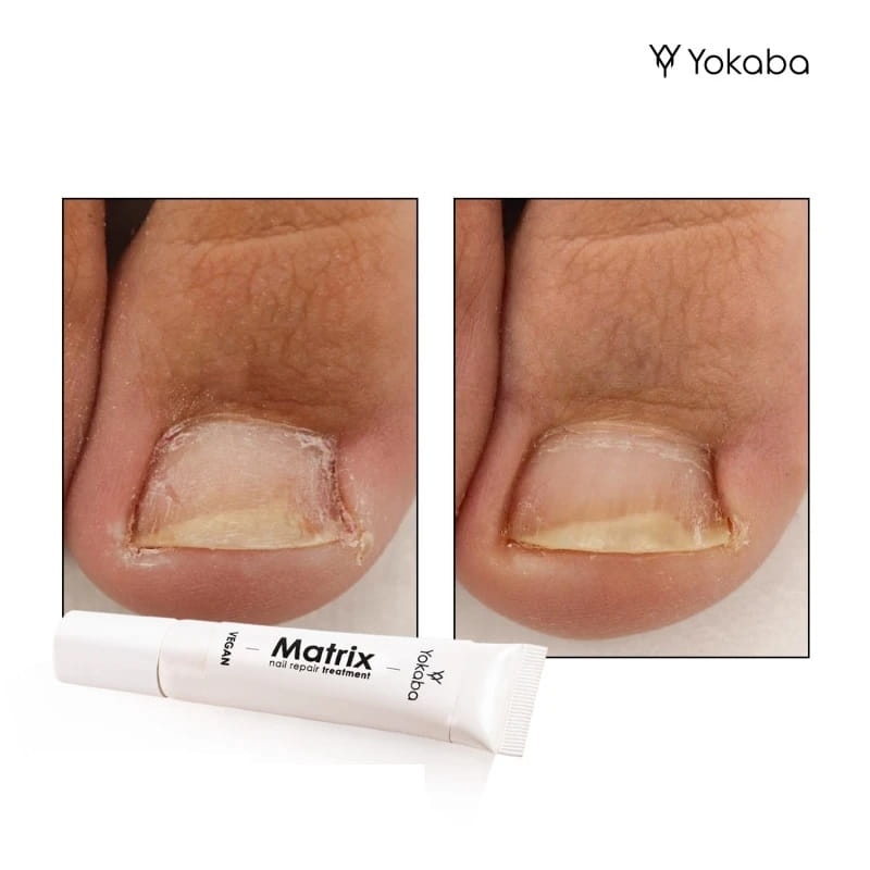 Yokaba matrix nail repair treatment Preparat do regeneracji paznokci 15g