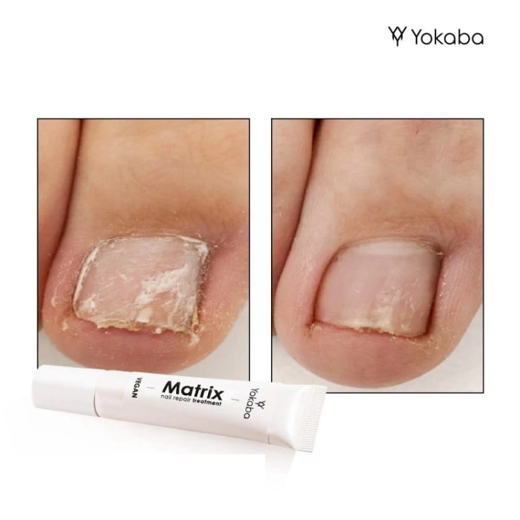 Yokaba matrix nail repair treatment Preparat do regeneracji paznokci 15g