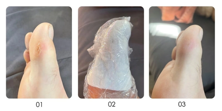 Yokaba podotherapy burst Żel do usuwania zrogowaciałej skóry pięty i modzeli 250ml