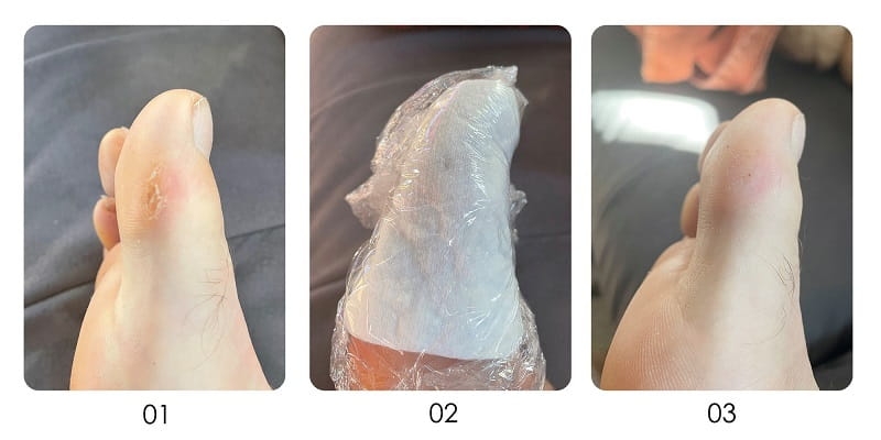 Yokaba podotherapy burst Żel do usuwania zrogowaciałej skóry pięty i modzeli 250ml