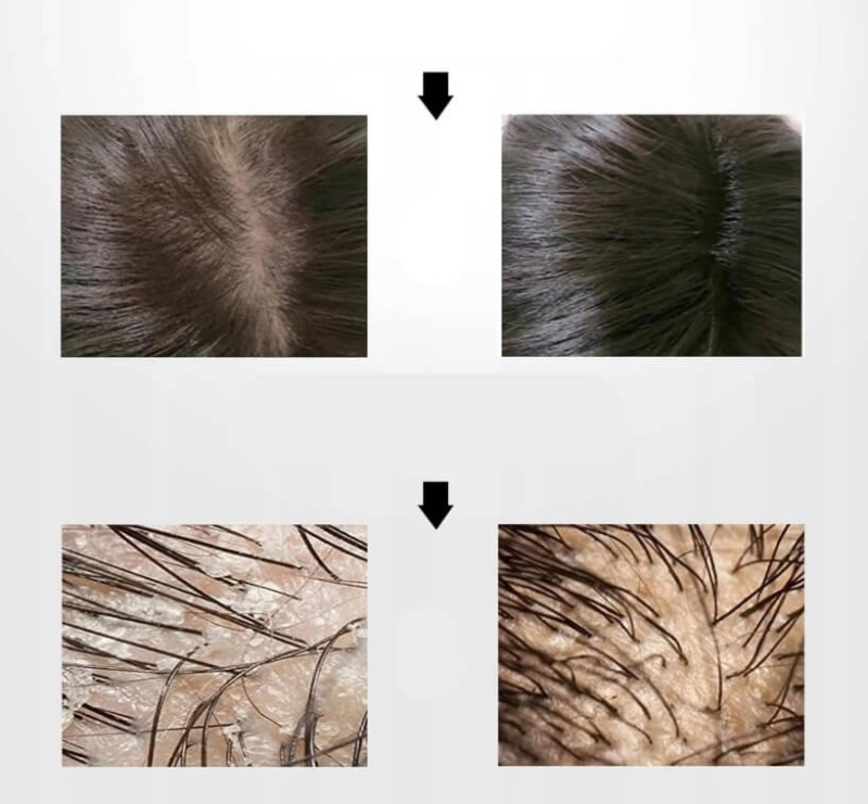 Scalp brush Borovsky Szczotka do pielęgnacji włosów i skóry głowy złota.jpg