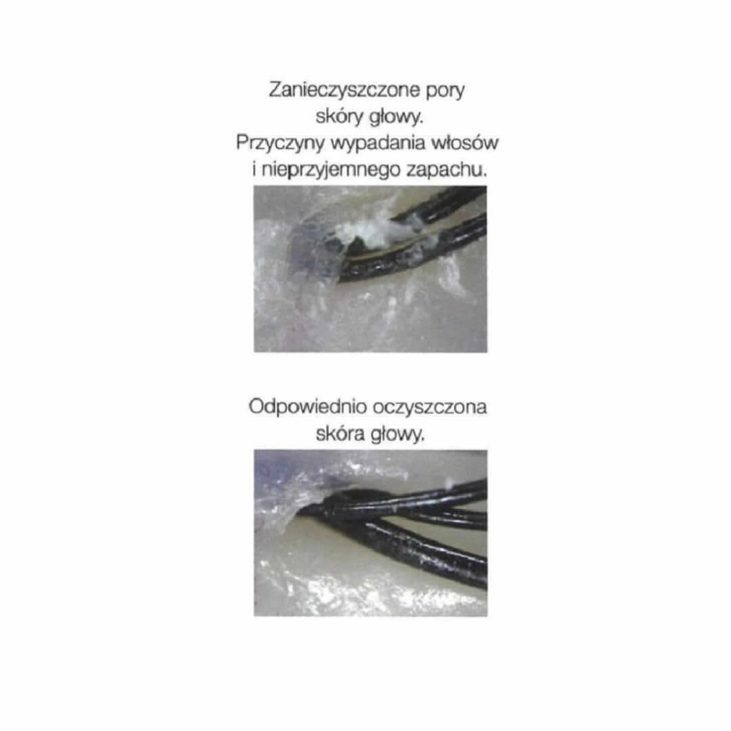 Scalp brush Borovsky Szczotka do pielęgnacji włosów i skóry głowy złota.jpg